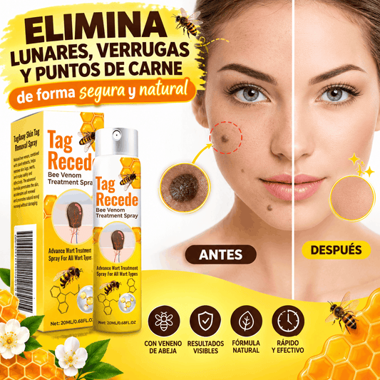 Elimina verrugas sin dolor